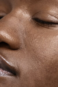 best cleansers for oily skin
